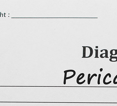 Global Pericarditis Drugs Market 2019-2023